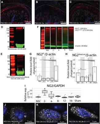 NG2/CSPG4 regulates cartilage degeneration during TMJ osteoarthritis